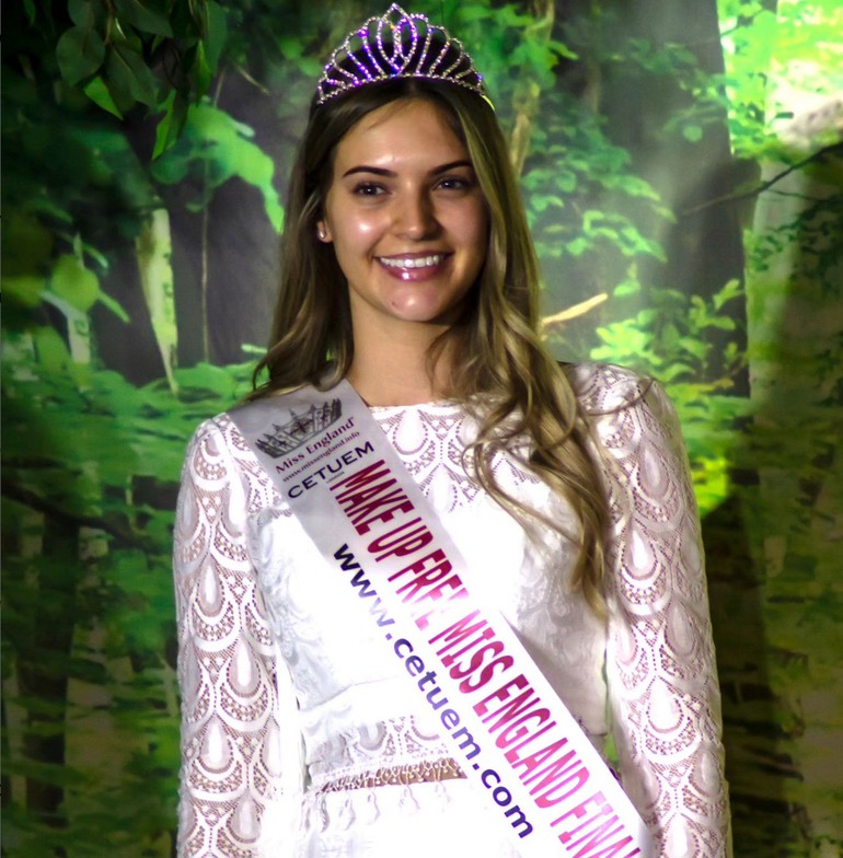 Natasha Beresford Pemenang Kontes Kecantikan Tanpa Make - Up