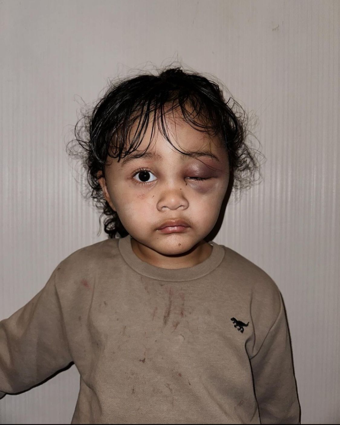 Anak Selebgram Aghnia Dianiaya Oleh Pengasuhnya