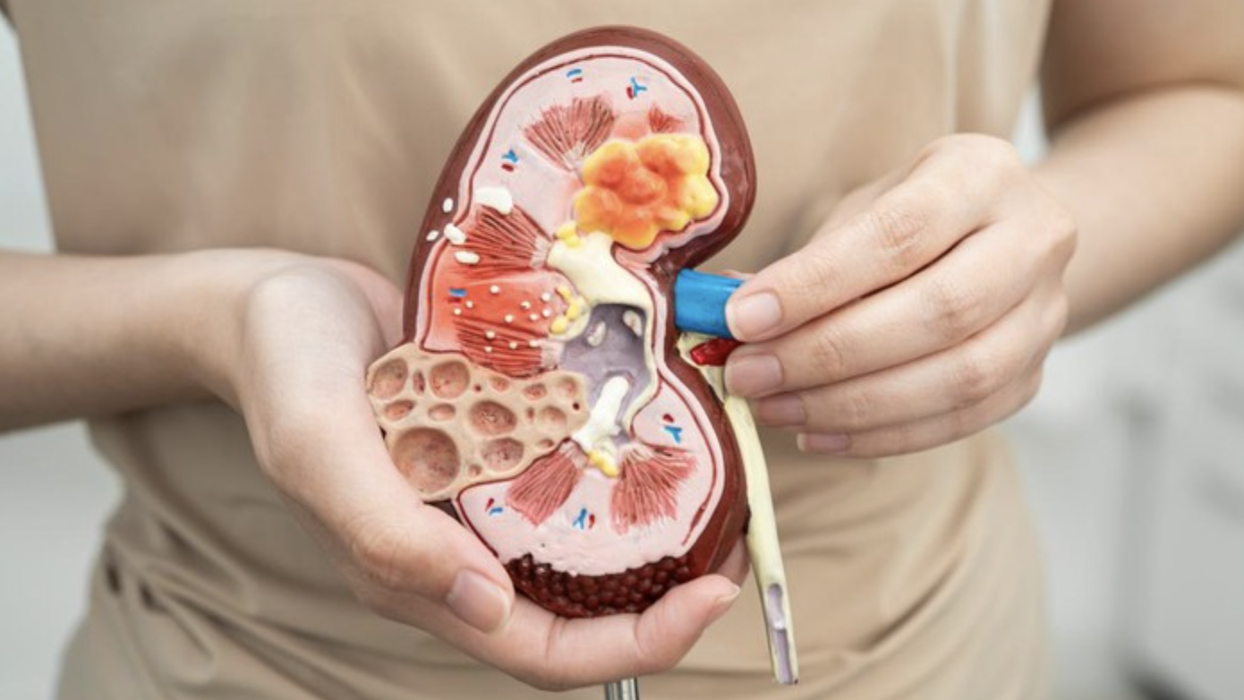 3 Fakta Penting: Minum Air Putih Bisa Bantu Keluarkan Batu Ginjal Secara Alami