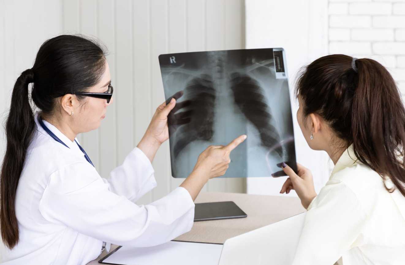 Waspada! Ternyata Bukan Hanya Rokok, Ini Makanan yang Diam-diam Memicu Kanker Paru-Paru