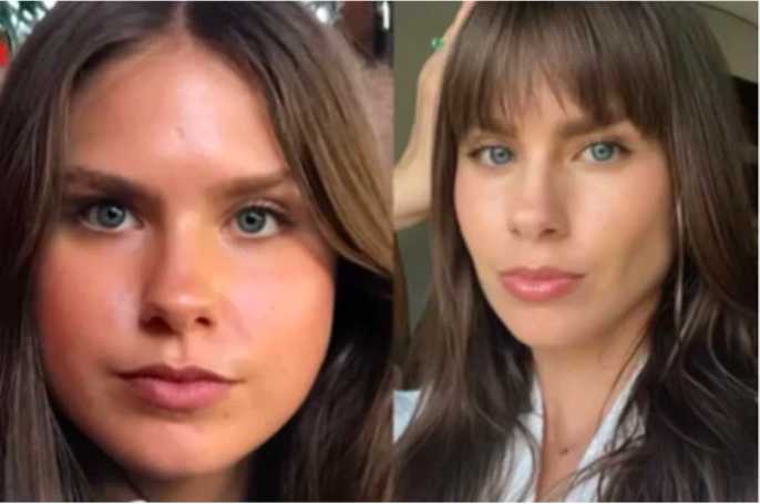 Bangun Tidur Wajah Terlihat Bengkak Padahal Tidak Gemuk? Waspada Gejala Cortisol Face