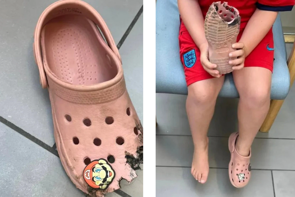 Sandal Crocs Dilarang Digunakan di Tempat Umum di Australia