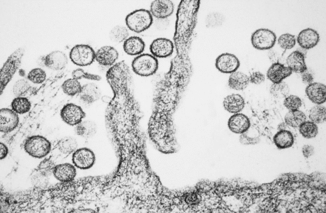 Sebaran Kasus Virus Hanta di Indonesia: 4 Provinsi yang Terdampak