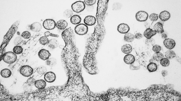Sebaran Kasus Virus Hanta di Indonesia: 4 Provinsi yang Terdampak