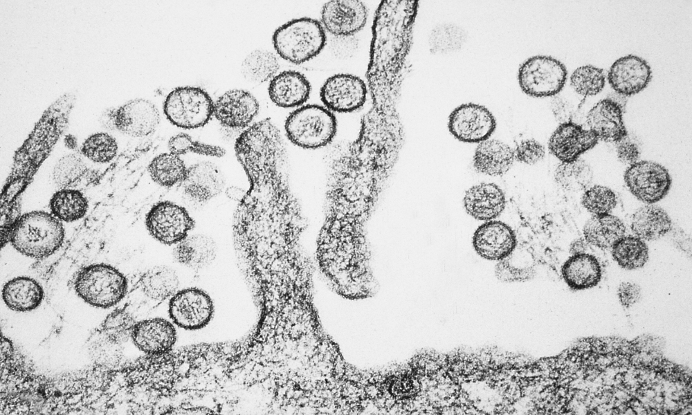 Sebaran Kasus Virus Hanta di Indonesia: 4 Provinsi yang Terdampak