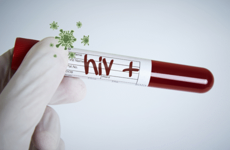HIV