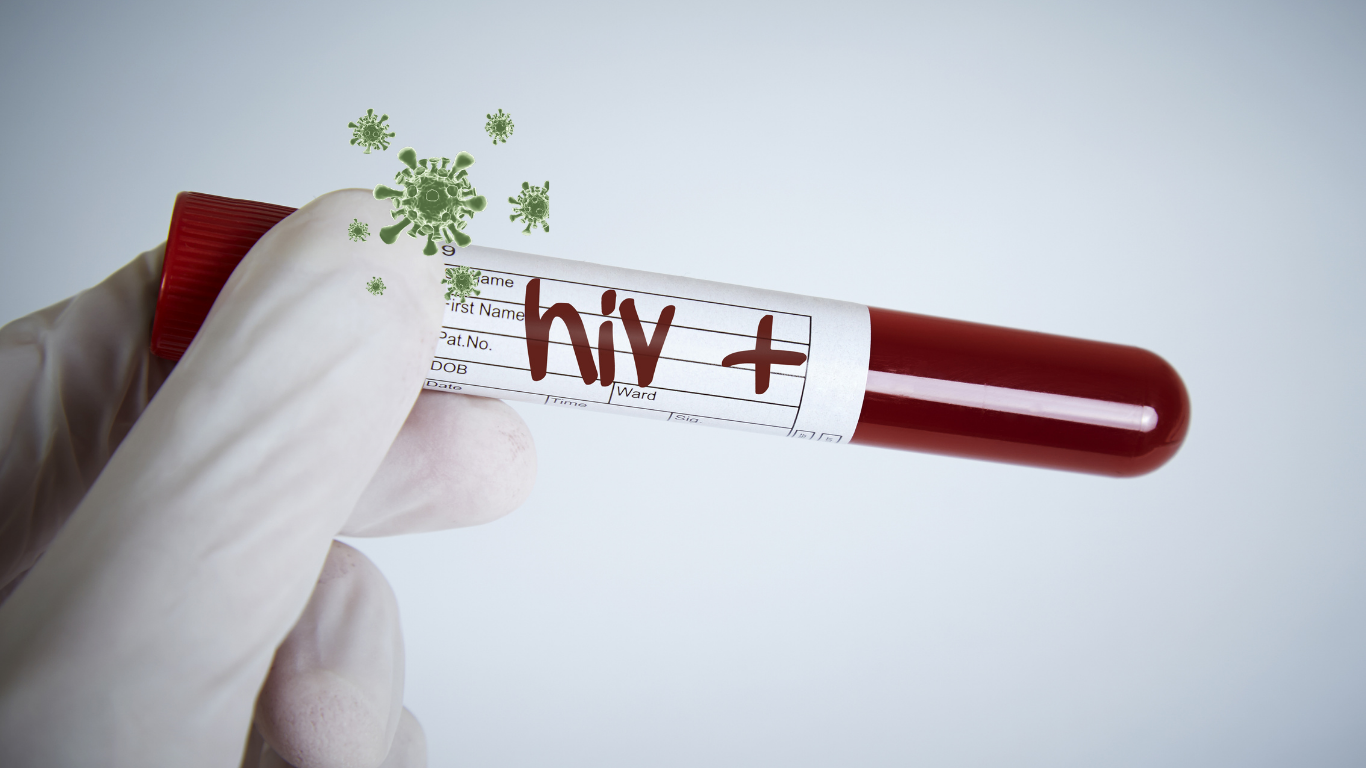 HIV