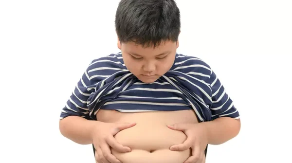 obesitas