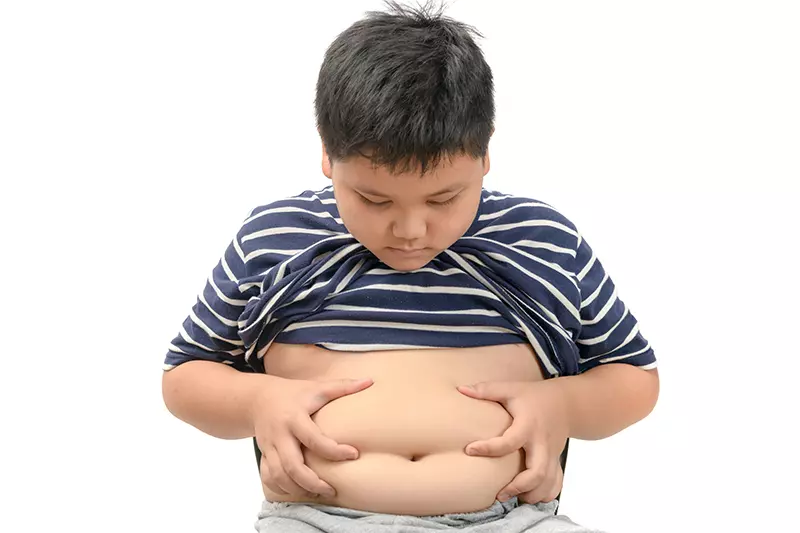 obesitas
